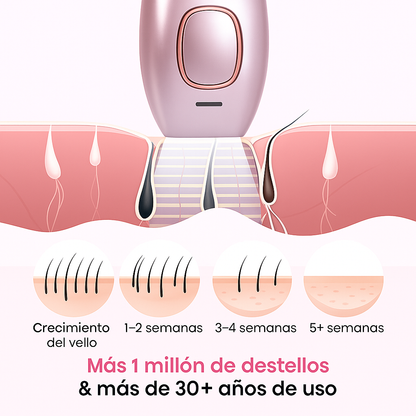 Depiladora Laser IPL | Elyse
